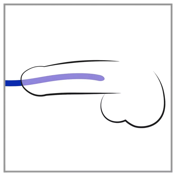 You2Toys - dilatorsæt - fleksibel silikone 3 stk